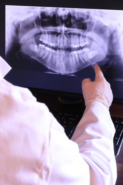 Best Emergency Treatment for Dental Infections or Abscesses in Lake City, SC